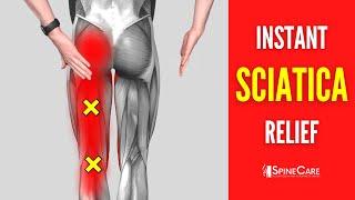 How to Fix Sciatica Pain at Home