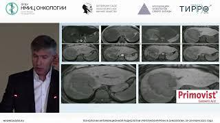 Возможности МРТ с гепатотропным контраст. препаратом на основе гадоксетовой кислоты для диагностики