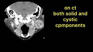 WARTHIN TUMOR RADIOLOGY ON EACH MODALITY.......