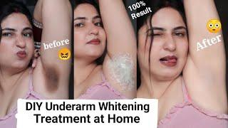 I Got Shocked to See - 100% result Underarms Whitening Home Remedy | DIY UNDERARMS WHITENING AT HOME