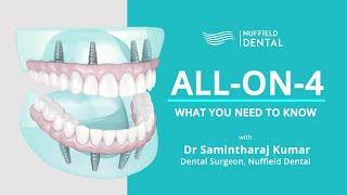 What is All-On-4? with Dr Samintharaj Kumar, Dental Surgeon, Nuffield Dental