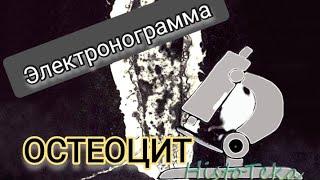 ОСТЕОЦИТ (электронограмма)