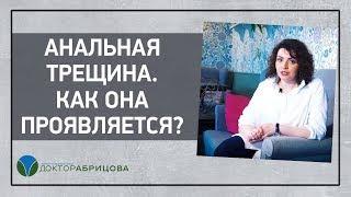 Анальная трещина. Как она проявляется? Отвечает Марьяна Абрицова