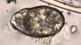 scabies mite in egg