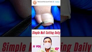 Wao  Very Simple Nail Cutting  Satisfying Nail Cleaning l ASMR Manicure Pedicure At Home #nails