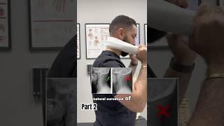 Do you struggle from with headaches or neck pain?  Try these chiropractic home tips! Part 2