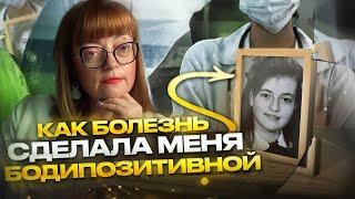 Как болезнь сделала меня бодипозитивной