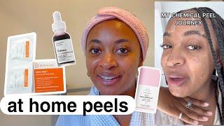 the best of at home chemical peels | safe for dark skin 