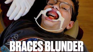 GETTING BOTTOM BRACES PUT ON FOR THE FIRST TIME BUT HIS MOUTH WON'T CLOSE!