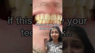 VIRAL PRODUCT makes teeth white #trending #shorts