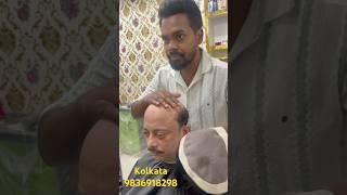 Men’s hair patch in Kolkata. Best hair wig centre in Kolkata. Human hair patch. Non surgical patch