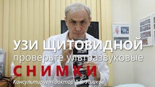 УЗИ щитовидной железы: Снимки, Стоимость (цена) Снимков УЗИ, Какие снимки УЗИ... || Доктор Ушаков