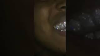 xxxtentacion showing off his grills