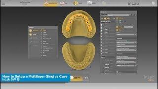 inLab SW 18: How to Setup a Multilayer Gingiva Case