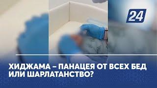 Хиджама – панацея от всех бед или шарлатанство?