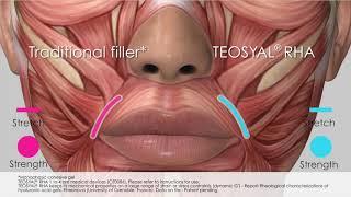 RHA Anatomy video EN