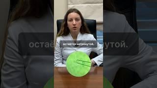 ПГТ опасно? ️ #репродуктолог #беременность #генетика