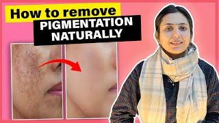 Natural Remedies for Pigmentation | Clear & Glowing Skin | Upasana Ki Duniya