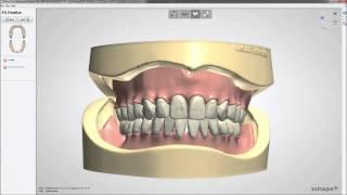 3D BioCAD - 3Shape Dental System Dentures