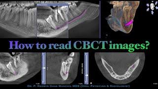 How to read CBCT images?