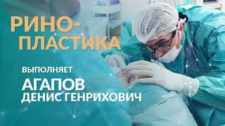 Пластика носа. Пластическая хирургия. Клиника Дега.