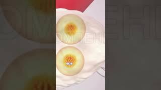 #эко билан инсеминация фарки #inseminatsiya