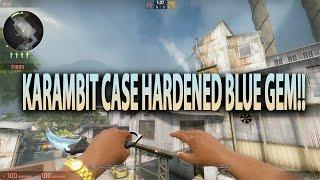 Karambit Case Hardened 100% BLUE GEM Showcase (Factory New)