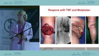 The Role of Chemoperfusion in Oncology