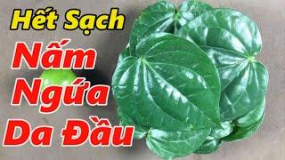 Chữa DỨT ĐIỂM NẤM DA ĐẦU Nhanh Chóng Trong 7 Ngày Chỉ Với 1 Nắm Lá Trầu Không_Mẹo chữa bệnh