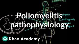 Poliomyelitis pathophysiology | Infectious diseases | NCLEX-RN | Khan Academy