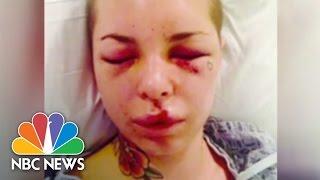 Christy Mack Assaulted By MMA's 'War Machine' | NBC News