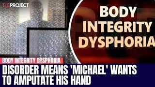 Body Integrity Dysphoria Means 'Michael' Wants To Amputate His Hand