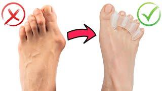 Build Healthy Feet - BEST TOE SPACERS