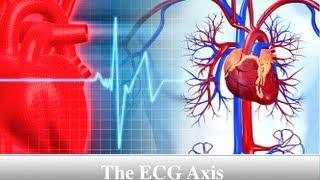 ECG Axis Tutorial: Part 5 - R-wave Progression