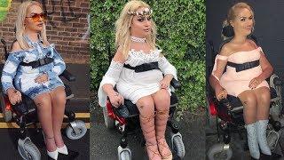 Beauty Blogger With Spinal Muscular Atrophy Has Amazing Makeup Skills