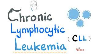 Chronic Lymphocytic Leukemia (CLL) - Etiology, Risk Factors, Symptoms, Signs, Diagnosis, Treatment