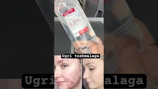 Ugriga qarshi losion