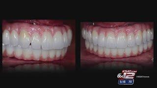 VIDEO: CAD CAM: Making New Teeth