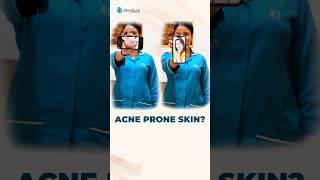 Best Acne Treatments for Clear Skin | SkinQure Clinic Solutions #skincare #acnetreatment