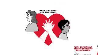 University of Essex - What is CPR? - A We Are Cognitive Explainer Animation