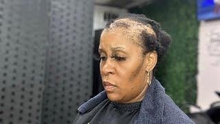 My client finally got her SCALP EXAM (alopecia update).