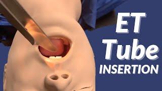 How to Insert an Endotracheal Tube (ET Tube)