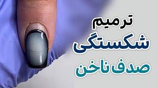 ترمیم شکستگی صدف ناخن