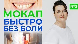 Протезирование зубов / Что такое мокап зубов?