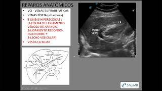 LOCALIZACION DE MASAS HEPATICAS POR US - SUB ENGLISH