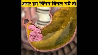 चिगम निगलने के खराब क्या होता है | Amazing fact #chewingggum #shorts