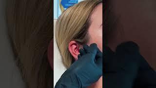 CONCH PIERCING
