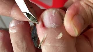 How to Repair Nails easy