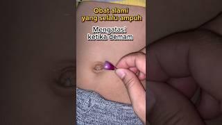 Obat alami yang selalu ampuh #lifeskills #tips #reallifehacks #tipspraktis