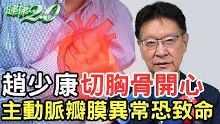 趙少康 切胸骨開心！ 主動脈瓣膜閉鎖不全 醫：恐增主動脈剝離 心臟衰竭風險 健康2.0 @tvbshealth20